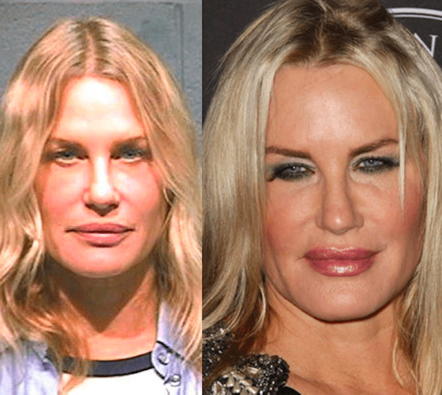 The Most Expensive Celebrity Cosmetic Surgery Page Of